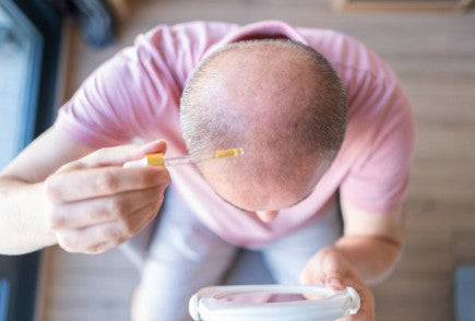 Should I Buy Batana Oil for Hair Loss?