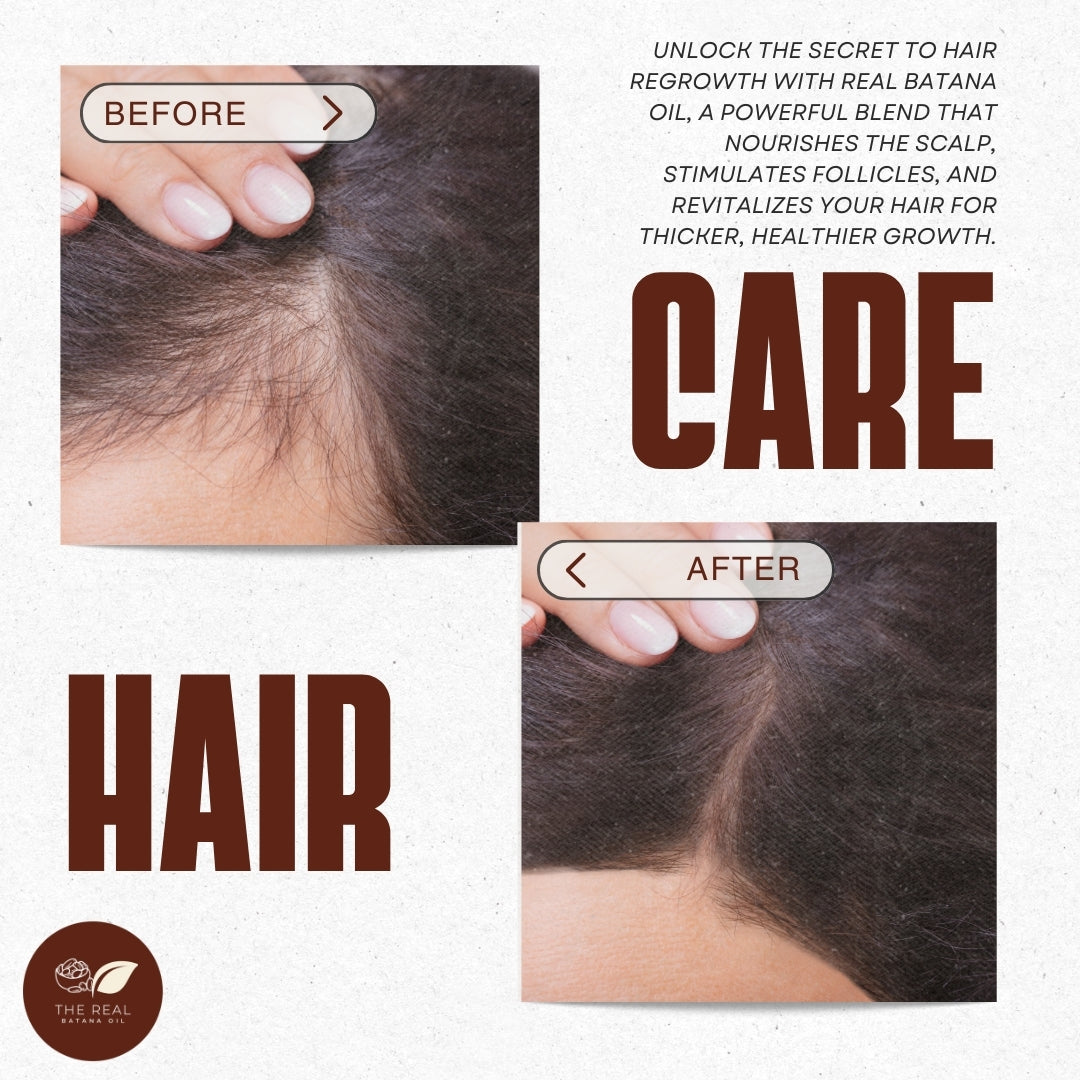 batana oil for hair loss