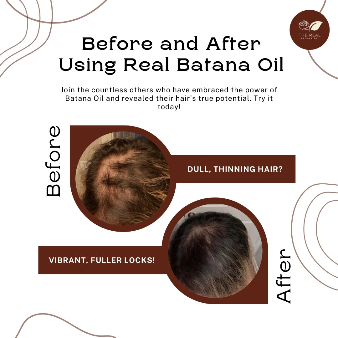 best batana oil for hair growth